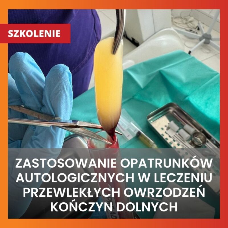 szkolenie opatrunki autologiczne